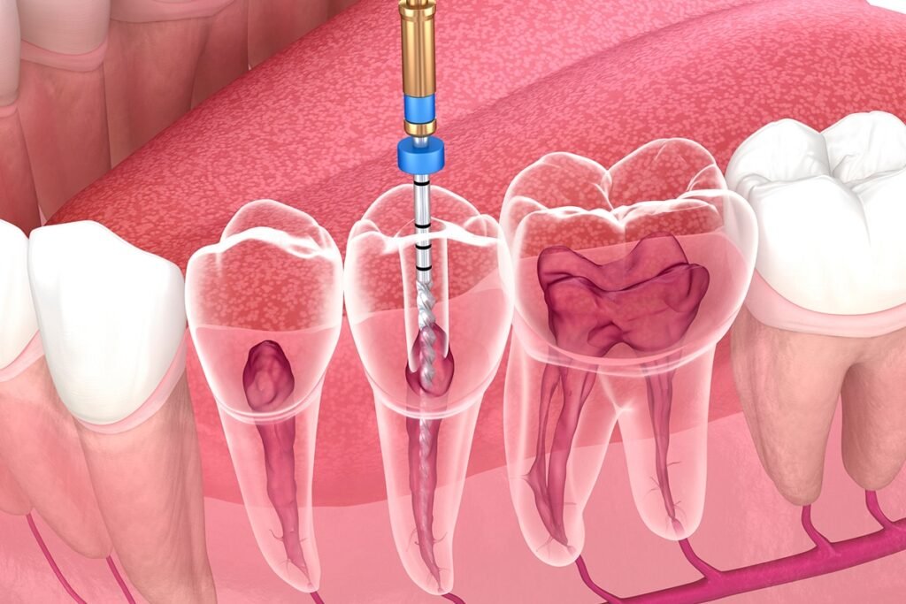 Pr Said Dhaimy réalisant un traitement endodontique à Casablanca